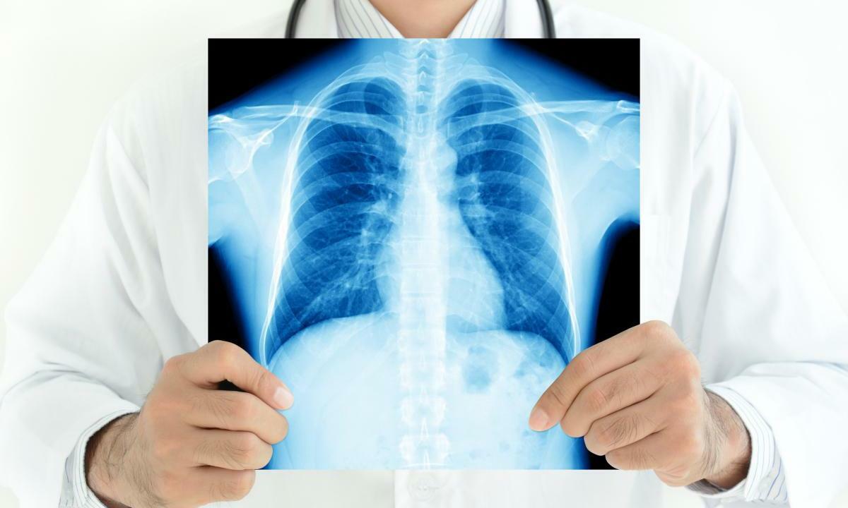 Диагностика туберкулеза