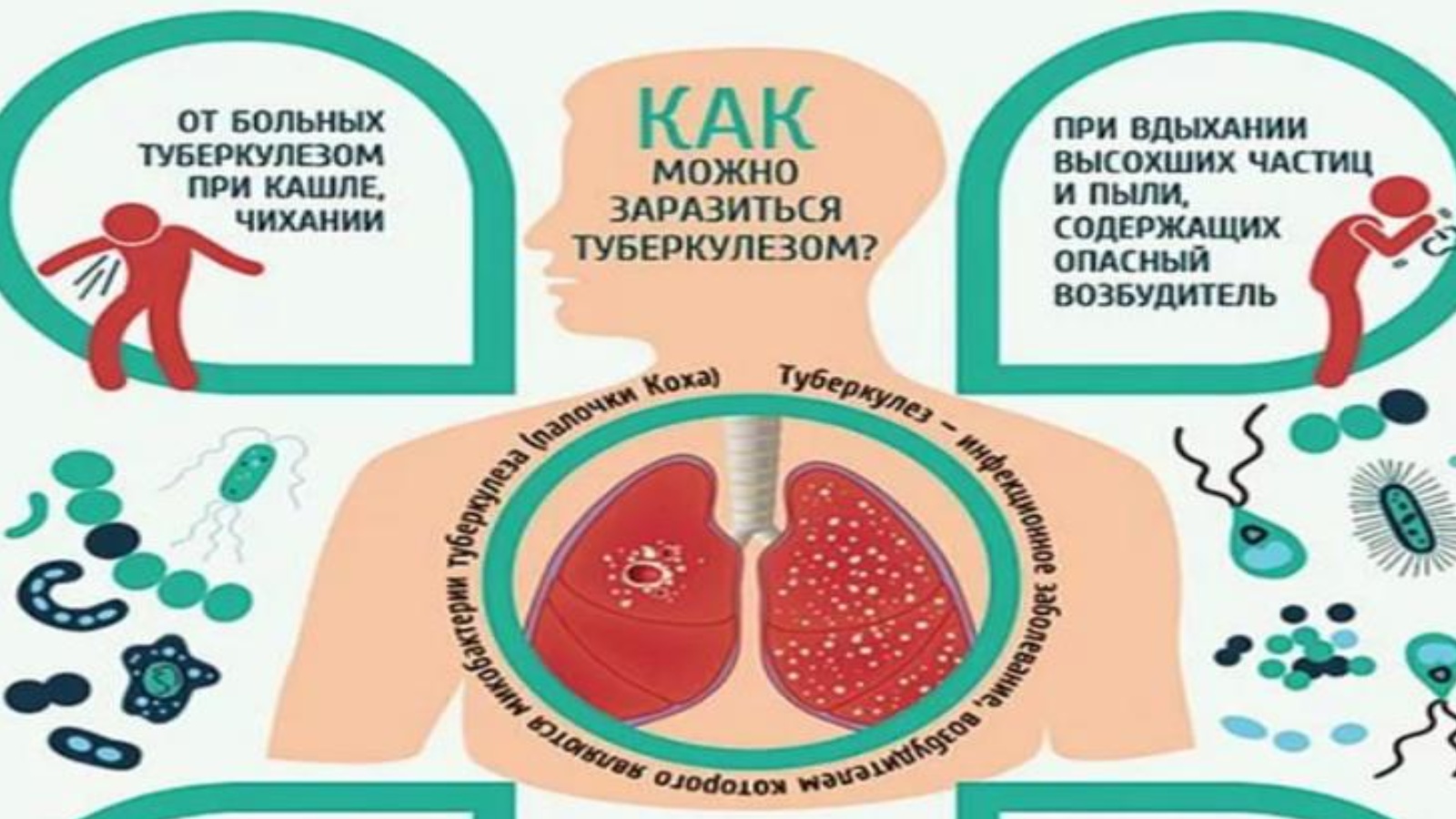Факторы развития туберкулеза легких
