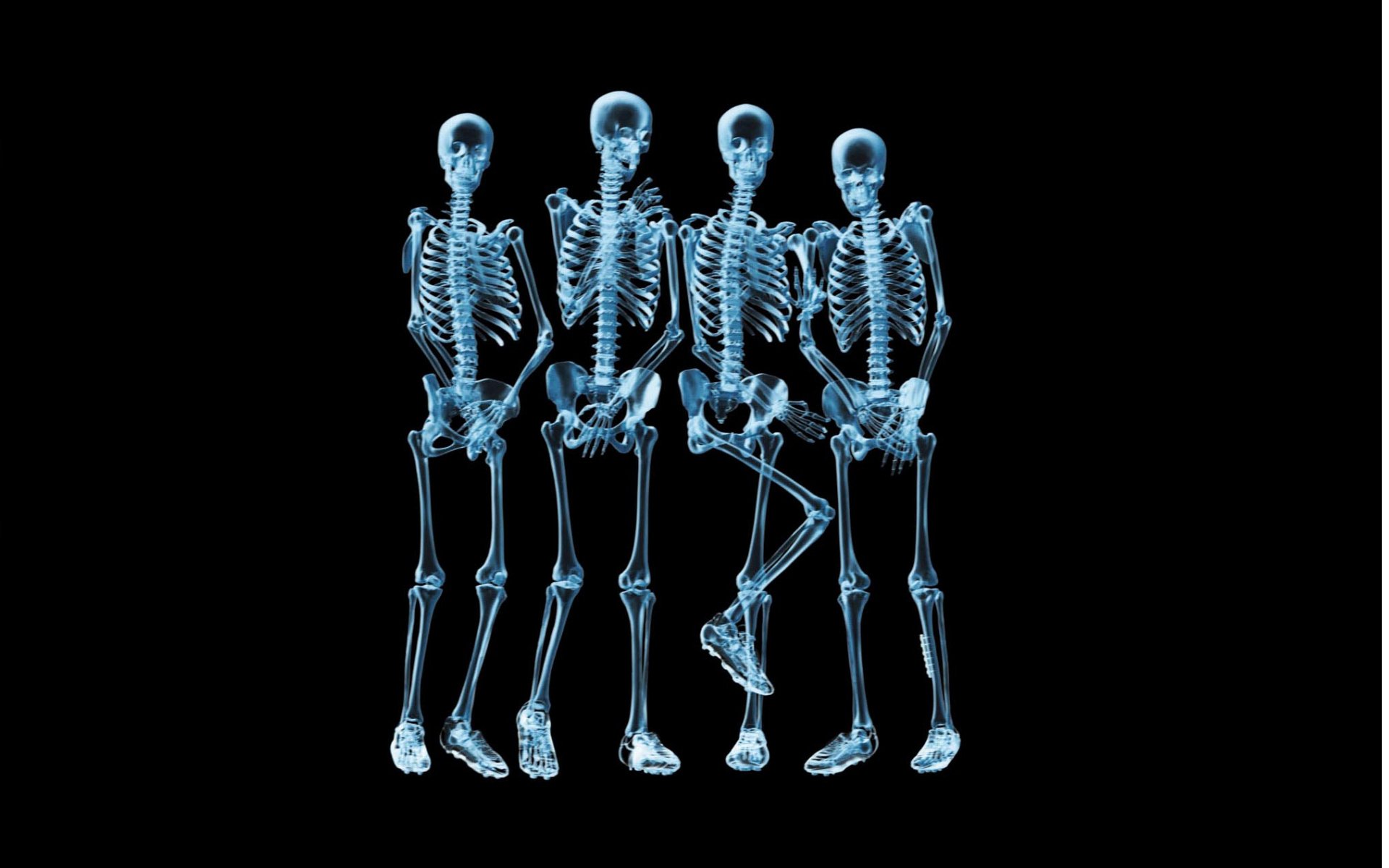 Рентген человека